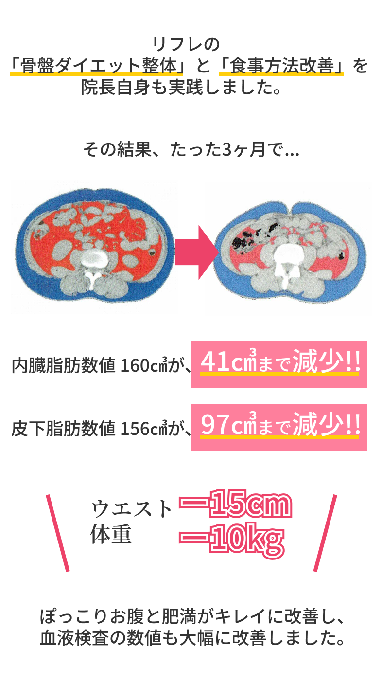 リフレの「骨盤ダイエット整体」と「食事方法改善」を院長自身も実践しました。その結果、たった3ヶ月で内臓脂肪数値１６０㎤が、３ヶ月で４１㎤まで減少皮下脂肪数値１５６㎤が、３ヶ月で９７㎤まで減少ウエストが、マイナス１５センチ体重がマイナス１０キロぽっこりお腹がキレイに改善し、血液検査の数値も大幅に改善しました。